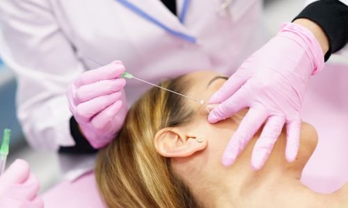 IS A VERTICAL PDO THREAD LIFT RIGHT FOR YOU?