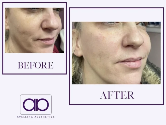 How to Properly Prepare Your Skin Before Aesthetic Treatments