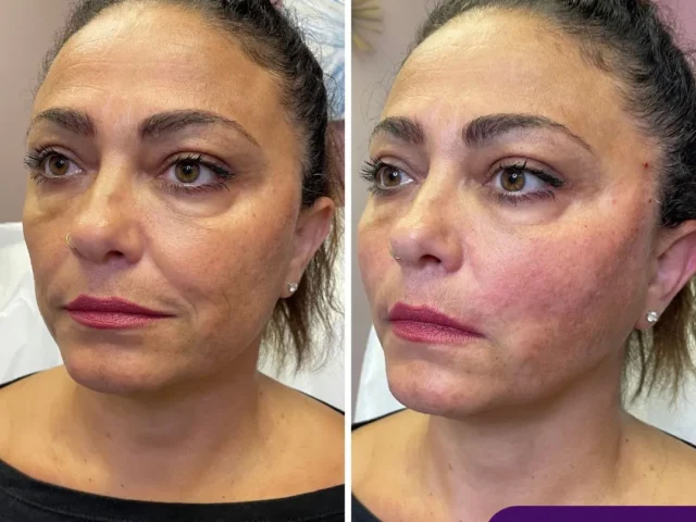 Professional Skin & Facial Treatments for All Skin Types
