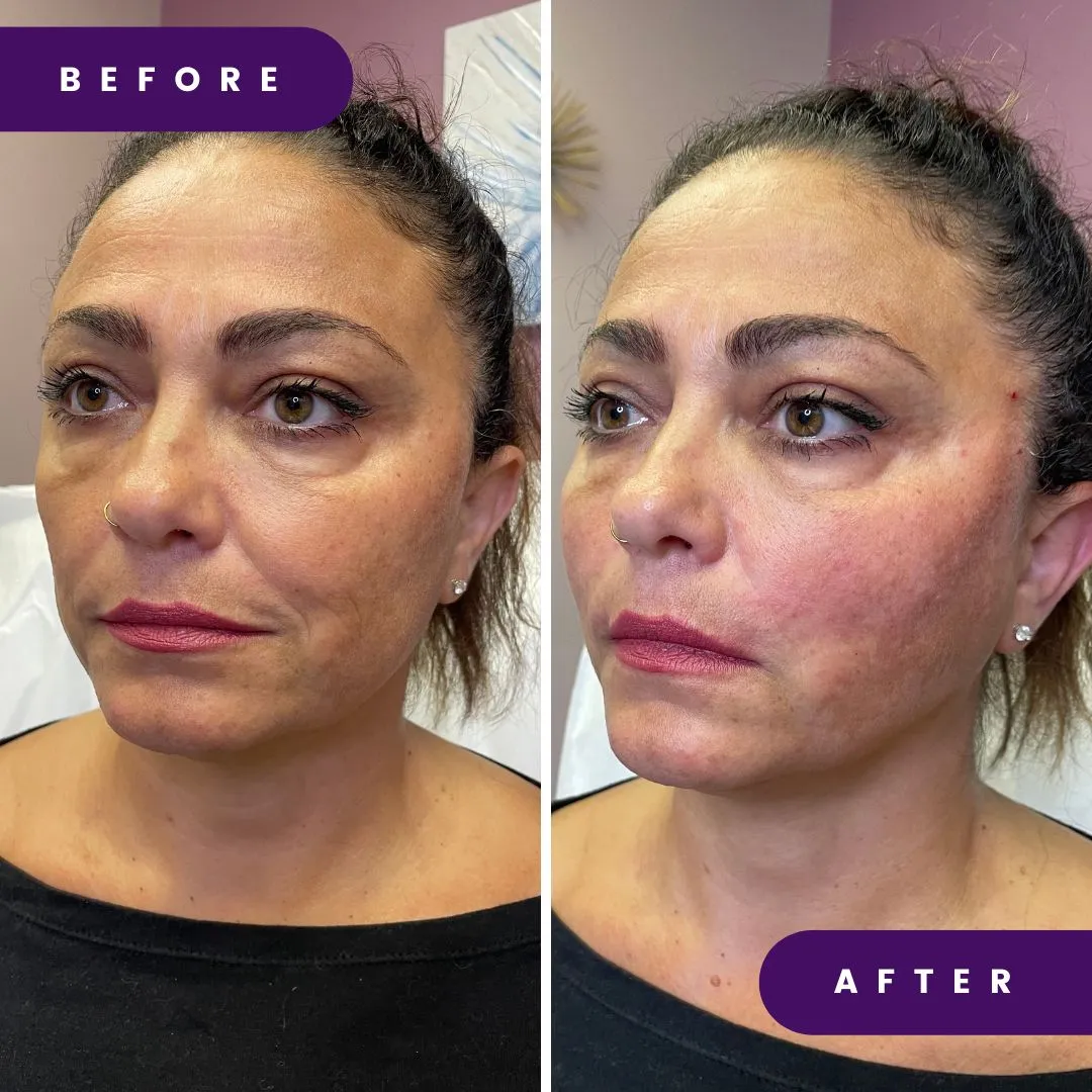 Professional Skin & Facial Treatments for All Skin Types